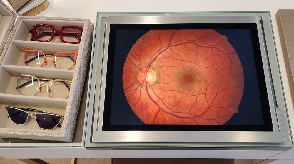 A detailed close-up of a human eye undergoing a digital retinal scan to check for diabetic retinopathy symptoms.